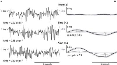 Idiosyncratic Characteristics of Postural Sway in Normal and Perturbed Standing